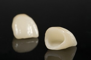 A photo of dental crowns, or tooth caps.