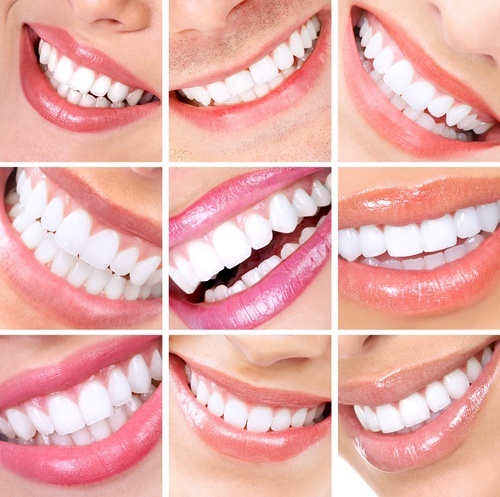 Teeth Whitening Near Me