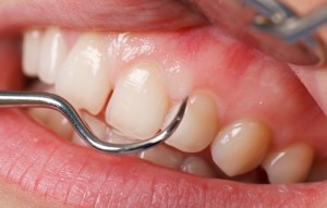 Gums in dentists office