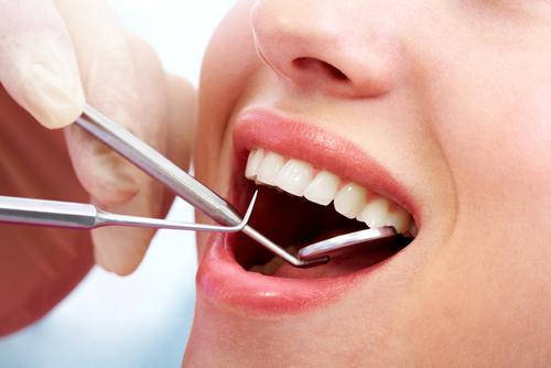 Affordable Teeth Cleanings in Las Vegas | Absolute Dental