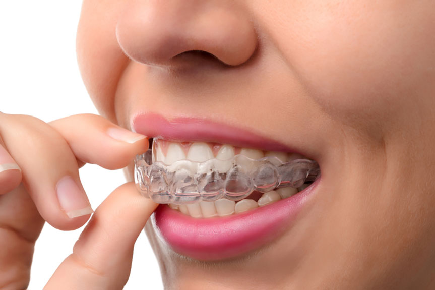 Orthodontic Web Design