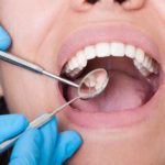 Dentist examining patient's teeth