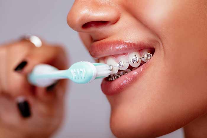 Brushing your braces