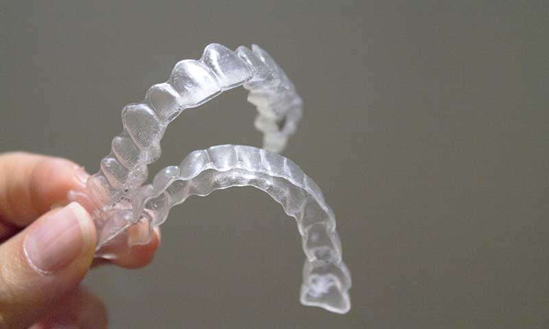 invisible braces