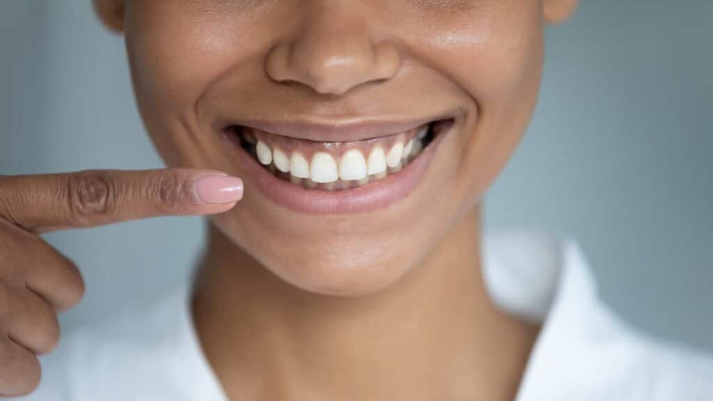 Smiling woman gums