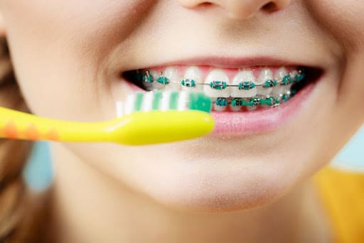Teen brushing her teeth with braces