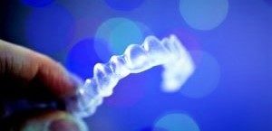 Invisalign Braces - Teeth Aligners