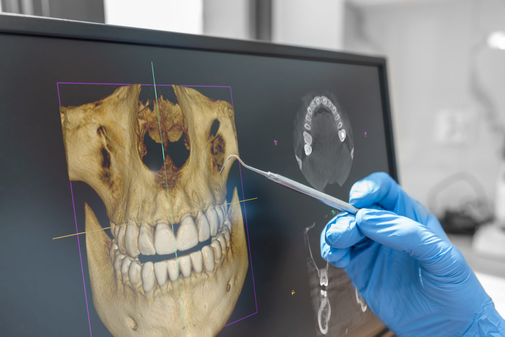 Dental consultation in clinic. Dentist showing 3D tomography image on screen