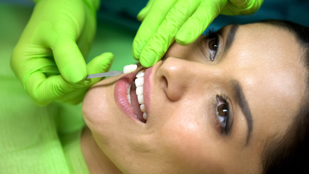 Stomatologist comparing color of natural tooth with sealant filling