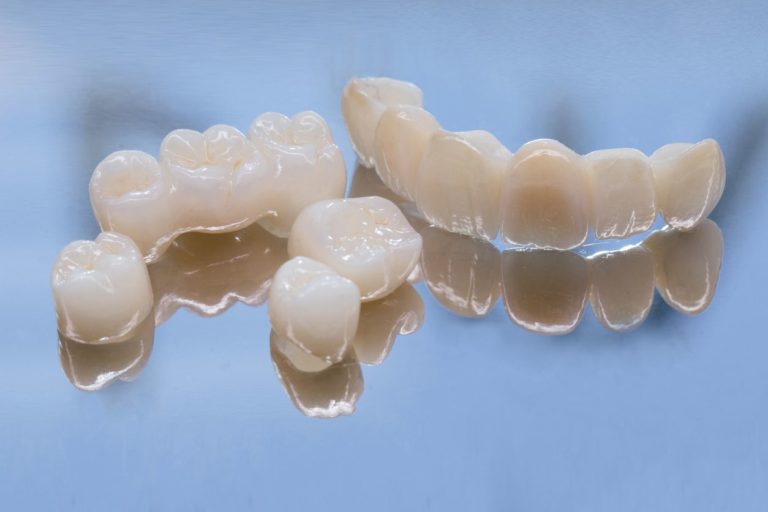 Metal Free Ceramic Dental Crowns. 