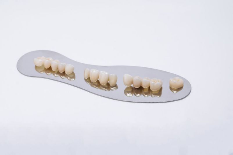 Metal Free Ceramic Dental Crowns at Absolute dental