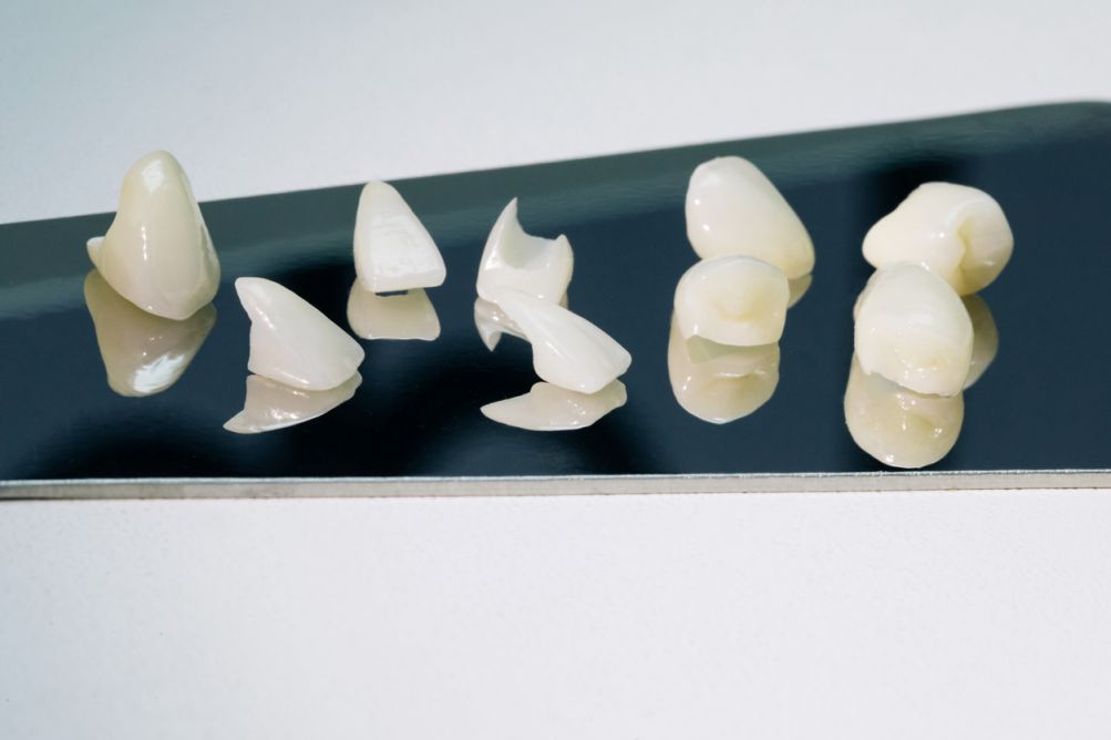 Zirconium crowns veneers.