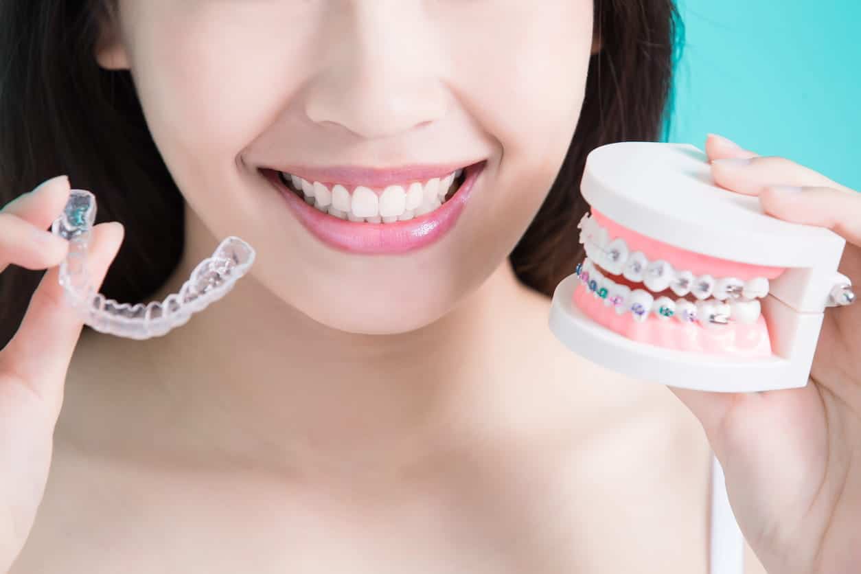 Braces vs Invisalign vs Smile Direct Club Absolute Dental