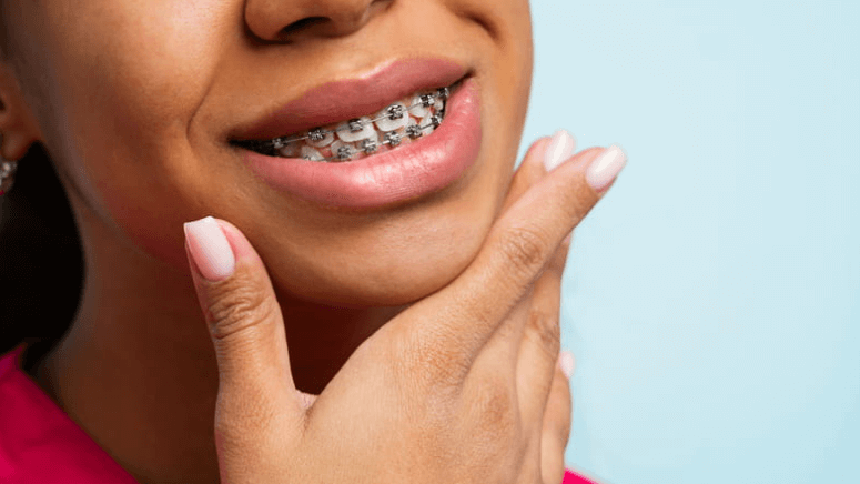 focus is on a woman's mouth as she's smiling with braces