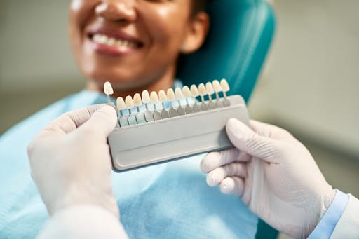 Benefits of veneers