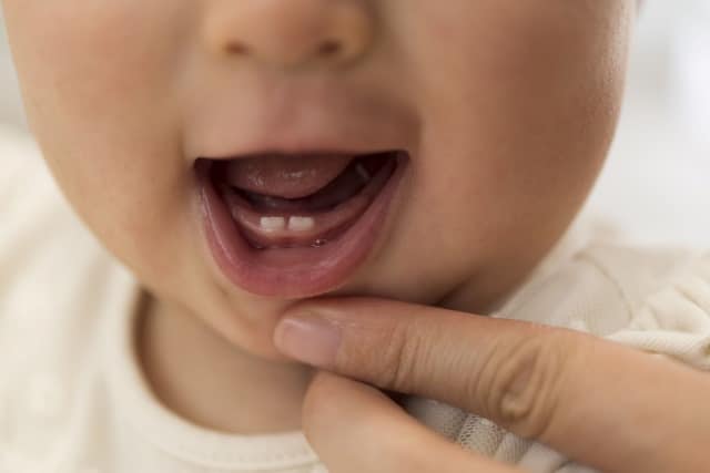 Baby teeth on a newborn