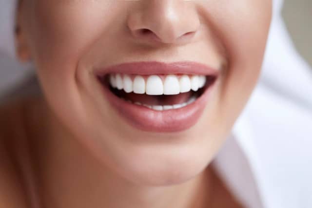 Woman with beautiful smile