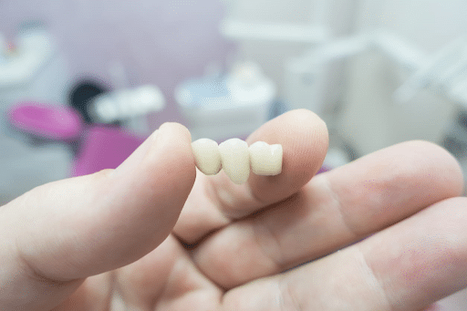 A dentist holds a dental bridge in their hand.