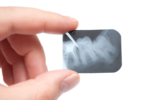 A periodontist holding a tooth X-ray.
