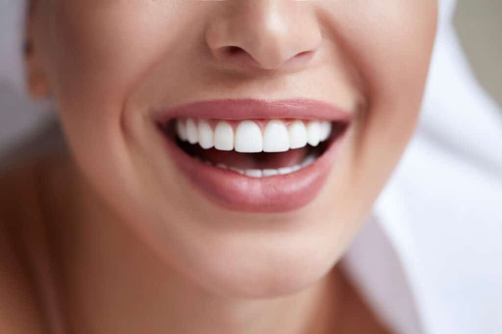 Smiling woman after dentist visit
