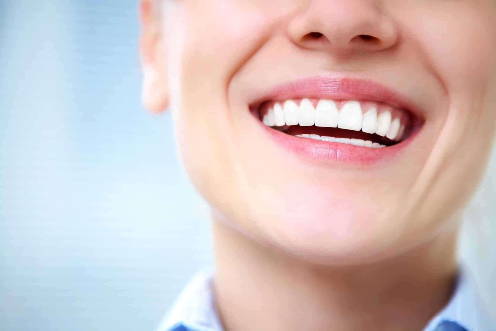 White teeth on smiling woman