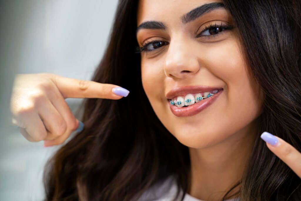 A woman smiling as she points at her metal braces in North Las Vegas. 