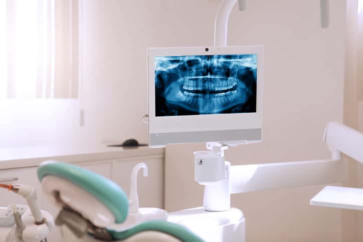 An empty dental chair with a mouth X-ray on the screen.