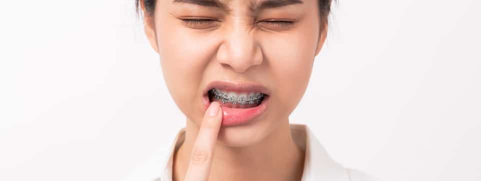 A teenager pointing to their mouth where their braces are hurting them.