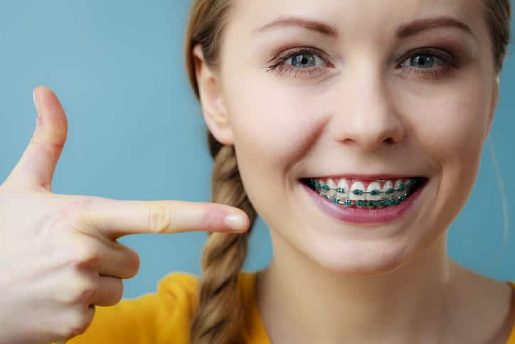 Focus is on a person pointing to their smile with metal braces.