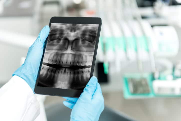 A dentist looking at a mouth X-ray.