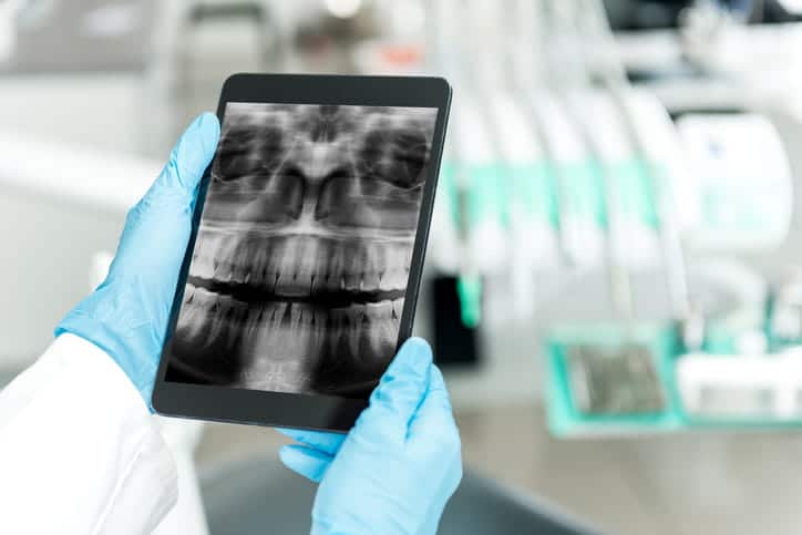 A dentist looking at a mouth x-ray.