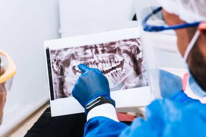An oral surgeon pointing at a dental X-ray.