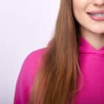 Focus is on a girl smiling while she shows off her metal braces.