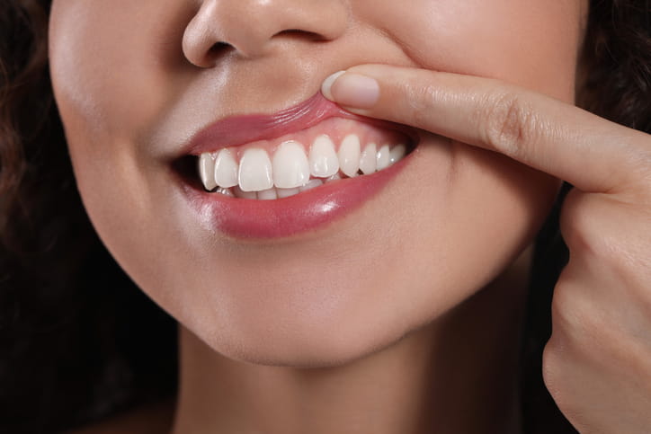 A woman showing her gums.
