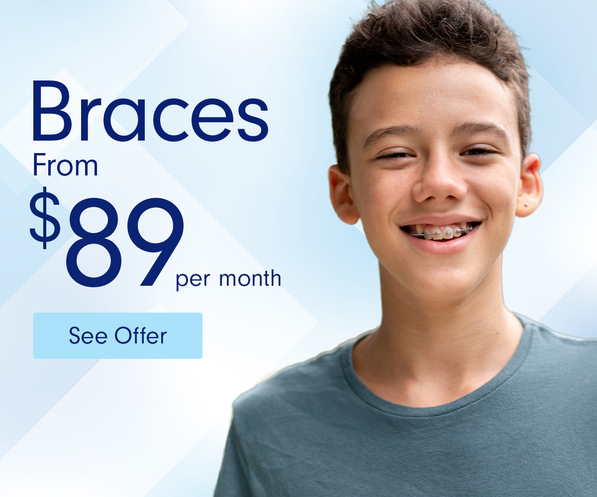Braces 89 per month