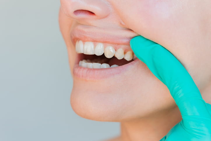 A dentist examines a patient's smile as they inspect the tooth enamel.