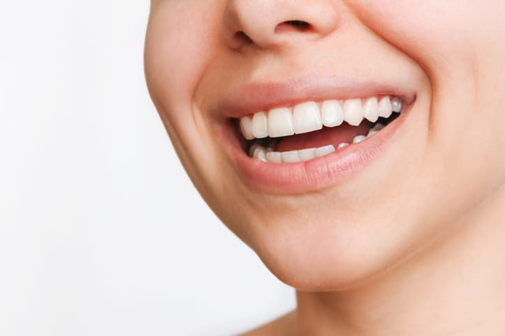 A woman smiling with a metal-free filling. 