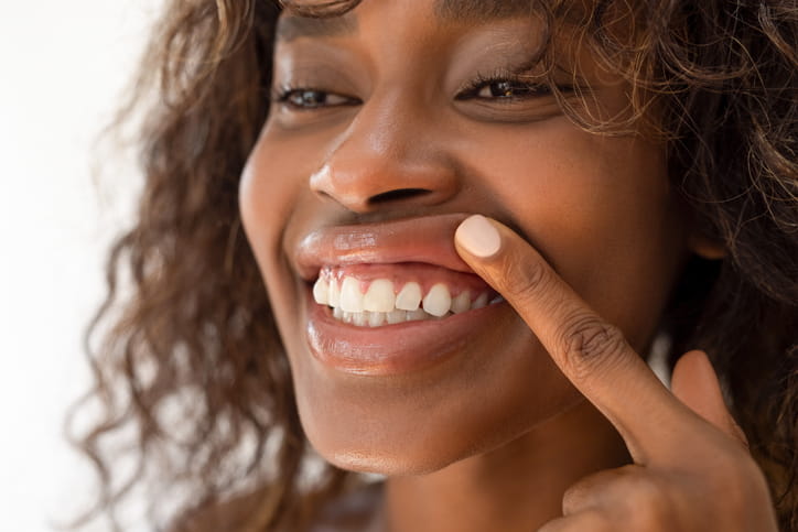 A woman lifts her lip while smiling as she shows off her healthy gums. 