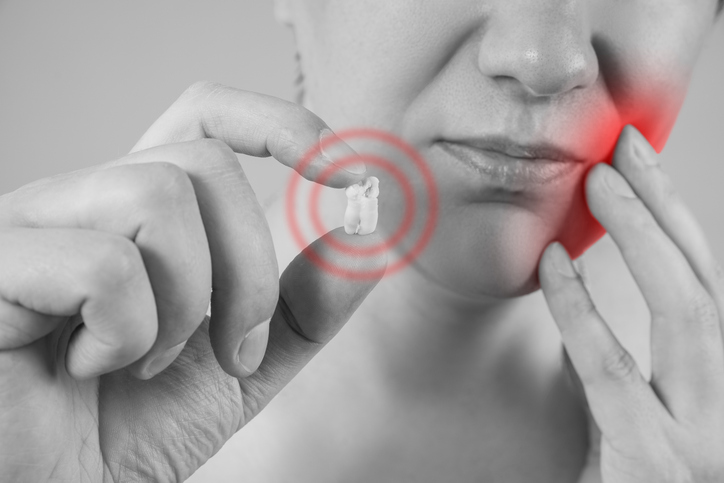Wisdom tooth extraction, man suffering from a toothache