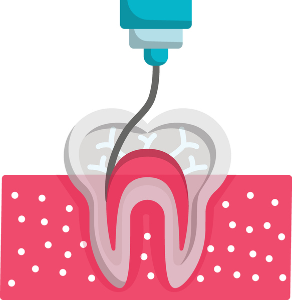 Root canal treatment vector color icon design