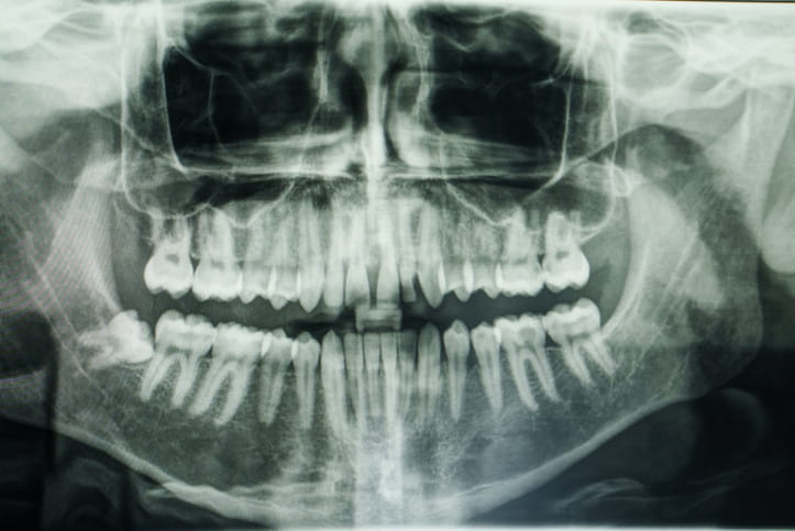 A dental X-ray.