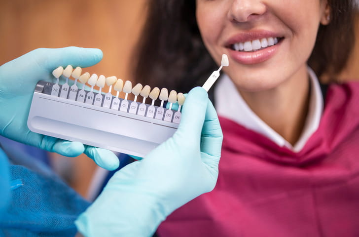 A dentist matching a veneer to a patient's smile. 
